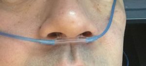 鼻に装着する呼気量計測計